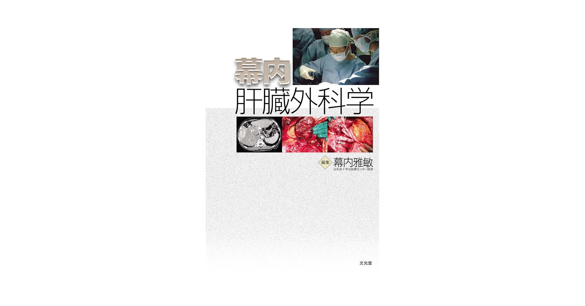 幕内肝臓外科学　幕内雅敏 Amazon.co.jp: 幕内肝臓外科学 : 幕内 雅敏: 本